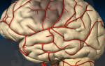 Сужение сосудов головного мозга у ребенка лечение симптомы причины