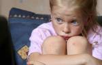Головная боль у ребенка 12 лет причины и лечение