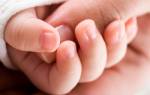 Заусенцы на пальцах рук у ребенка причины и лечение