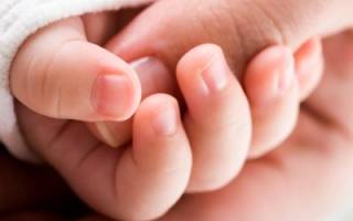 Заусенцы на пальцах у ребенка причины лечение комаровский