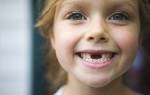 Почему у детей выпадают молочные зубы