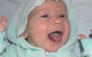 Белый толстый налет на языке плохо счищается у ребенка лечение