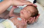 Врожденные патологии ЦНС у новорожденных