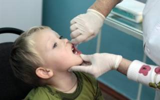 Можно ли делать прививку от полиомиелита если у ребенка сопли?