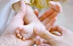 Шипица на пальце руки у ребенка лечение причины появление