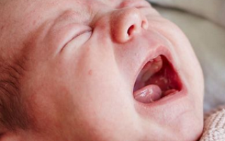 Белые прыщики во рту у ребенка 2 года лечение