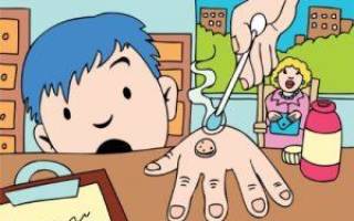 Бородавки на пальцах рук лечение в домашних условиях ребенку