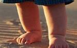 Грибок на ногах между пальцами у ребенка лечение