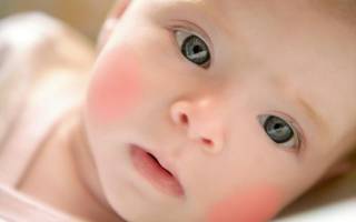 Аллергия у грудного ребенка на грудном вскармливании лечение