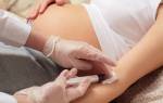 Анемия при беременности последствия для ребенка и лечение