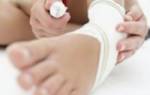 Растяжение связок голеностопа лечение в домашних у ребенка