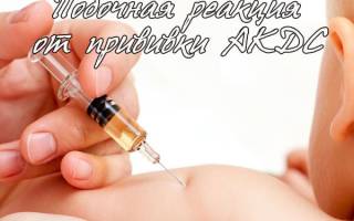 Акдс прививка побочные эффекты у 3 месячного ребенка
