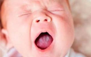 Молочница во рту у ребенка лечение народными средствами