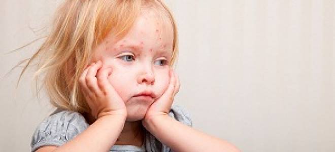 Аллергия у детей фотографии различной
