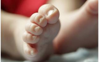 Белые пятна на ногтях рук у ребенка причины лечение