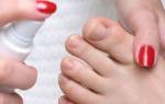Грибок ногтя на большом пальце ноги лечение у ребенка