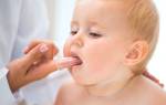 Язвочки на языке у ребенка лечение в домашних условиях быстро
