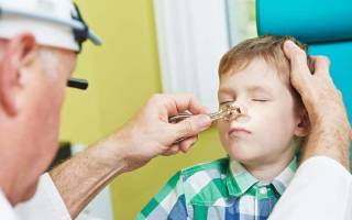 Что такое синусит у ребенка лечение и симптомы?