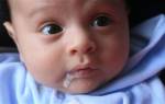 Почему возникают срыгивания у младенцев