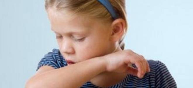 Если у ребенка кашель как собачий лай лечение