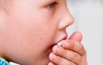 Сухой лающий кашель у ребенка без температуры с насморком лечение