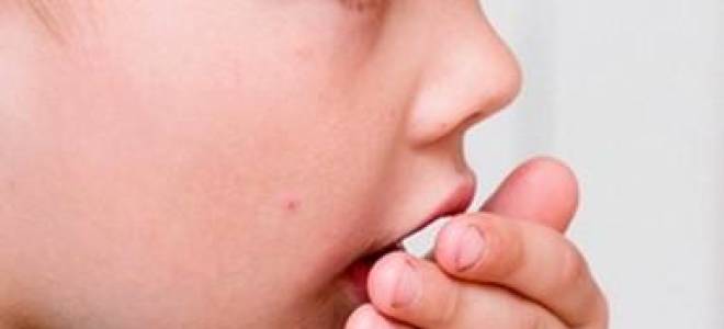 Лающий кашель у ребенка без температуры лечение 2 года