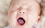 Налет на языке у ребенка до года лечение