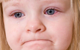Красные глаза у ребенка 2 года причины и лечение