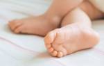 Сухая кожа на ногах у ребенка причины лечение