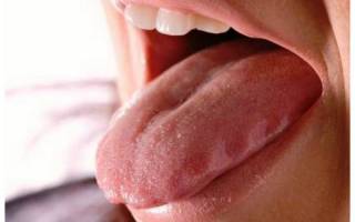 Красные пятна на языке у ребенка причины лечение