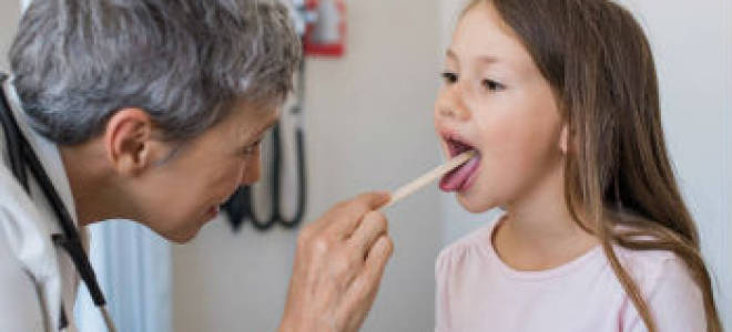 Фарингит у ребенка 3 лет симптомы и лечение